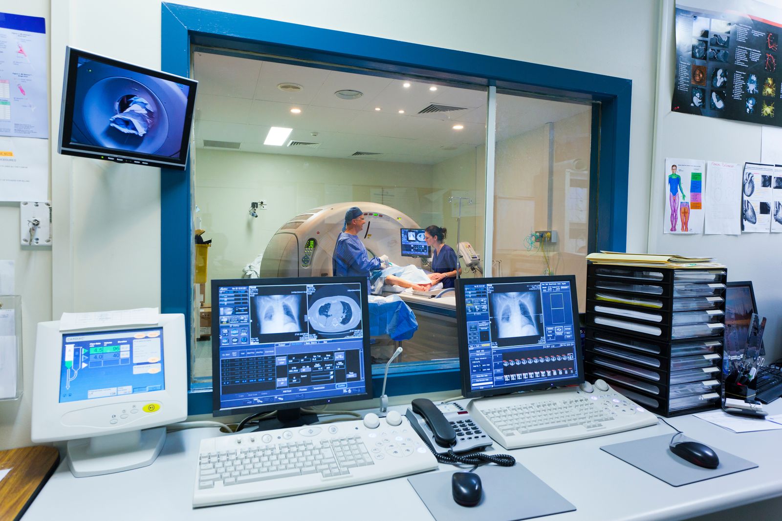 Radiographers at a scanner control desk, monitors showing diagnostic images through the observation window
